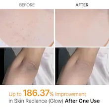 اسپری پیل شات کوجیک اسید دکتر ملاکسین لایه بردار و روشن کننده بدن | Dr.Melaxin Peel Shot Exfoliating Kojic Acid Turmeric Spray حجم ۲۰۰ میل