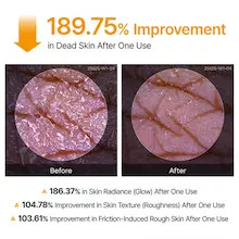 اسپری پیل شات کوجیک اسید دکتر ملاکسین لایه بردار و روشن کننده بدن | Dr.Melaxin Peel Shot Exfoliating Kojic Acid Turmeric Spray حجم ۲۰۰ میل