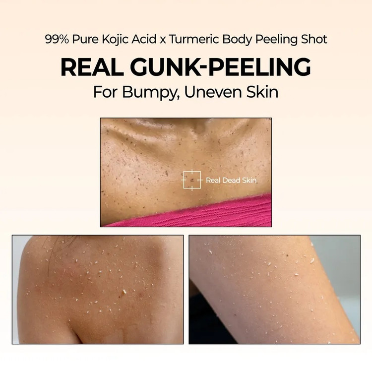 اسپری پیل شات کوجیک اسید دکتر ملاکسین لایه بردار و روشن کننده بدن | Dr.Melaxin Peel Shot Exfoliating Kojic Acid Turmeric Spray حجم ۲۰۰ میل